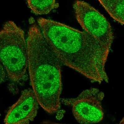 Immunocytochemistry/ Immunofluorescence: HBO1 Antibody [NBP1-92161]