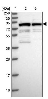 Western Blot: HBO1 Antibody [NBP1-92161]