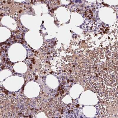 Immunohistochemistry-Paraffin: HBQ1 Antibody [NBP2-38960]