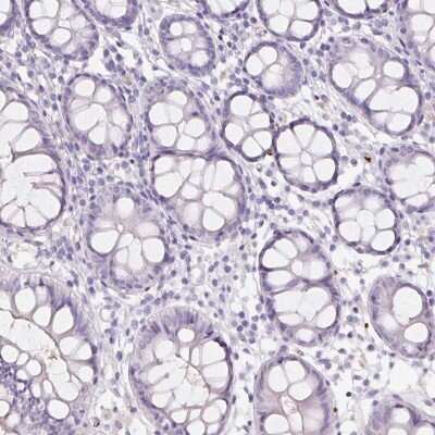 Immunohistochemistry-Paraffin: HBQ1 Antibody [NBP2-38960]