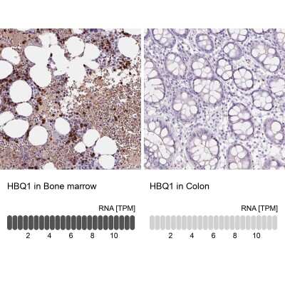 Immunohistochemistry-Paraffin: HBQ1 Antibody [NBP2-38960]
