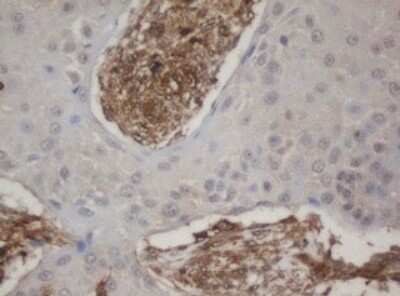 Immunohistochemistry: HBS1L Antibody (OTI1C1) - Azide and BSA Free [NBP2-71628]