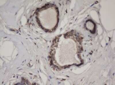 Immunohistochemistry: HBS1L Antibody (OTI1C1) - Azide and BSA Free [NBP2-71628]