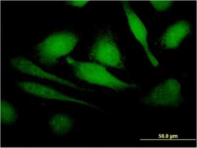 Immunocytochemistry/ Immunofluorescence: HBXIP Antibody (4G1) [H00010542-M12]