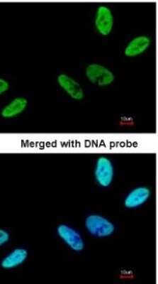 Immunocytochemistry/ Immunofluorescence: HCA59 Antibody [NBP1-32518]