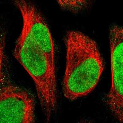 Immunocytochemistry/ Immunofluorescence: HCA59 Antibody [NBP1-83168]