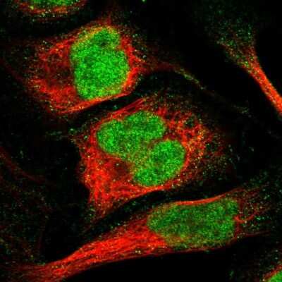 Immunocytochemistry/ Immunofluorescence: HCA59 Antibody [NBP1-83170]