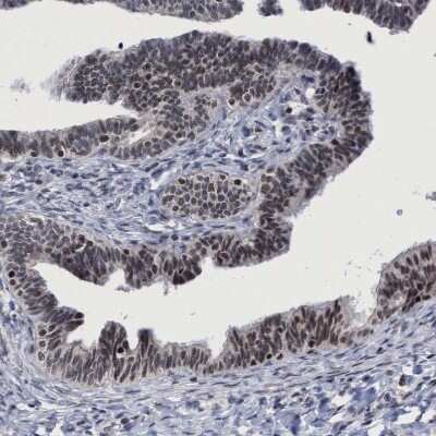 Immunohistochemistry: HCA59 Antibody [NBP1-83168]