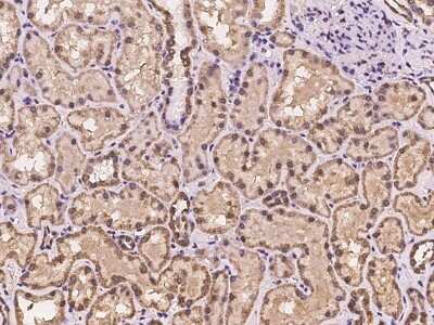 Immunohistochemistry: HCA59 Antibody [NBP3-06353]