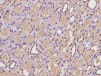 Immunohistochemistry: HCA59 Antibody [NBP3-06357]