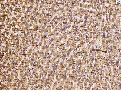 Immunohistochemistry: HCA59 Antibody [NBP3-06357]