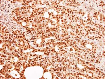 Immunohistochemistry-Paraffin: HCA59 Antibody [NBP1-32518]