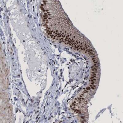 Immunohistochemistry-Paraffin: HCA59 Antibody [NBP1-83168]