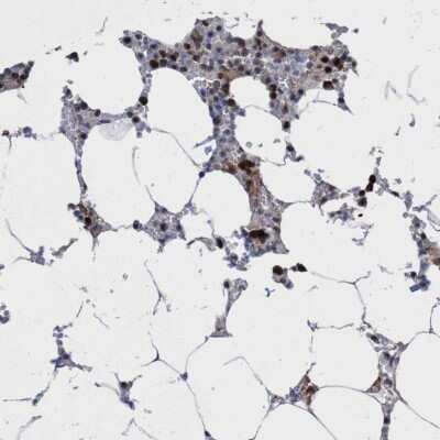 Immunohistochemistry-Paraffin: HCA59 Antibody [NBP1-83168]