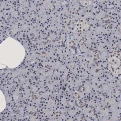 Immunohistochemistry-Paraffin: HCA59 Antibody [NBP1-83168]