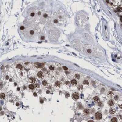 Immunohistochemistry-Paraffin: HCA59 Antibody [NBP1-83168]