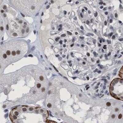 Immunohistochemistry-Paraffin: HCA59 Antibody [NBP1-83168]