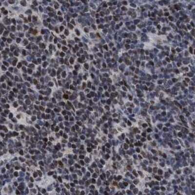 Immunohistochemistry-Paraffin: HCA59 Antibody [NBP1-83168]