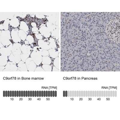 Immunohistochemistry-Paraffin: HCA59 Antibody [NBP1-83168]
