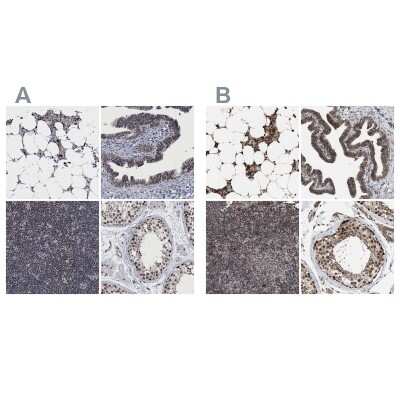 Immunohistochemistry-Paraffin: HCA59 Antibody [NBP1-83168]
