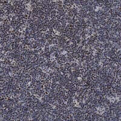 Immunohistochemistry-Paraffin: HCA59 Antibody [NBP1-83168]