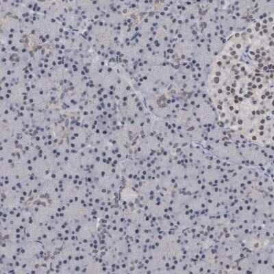 Immunohistochemistry-Paraffin: HCA59 Antibody [NBP1-83168]