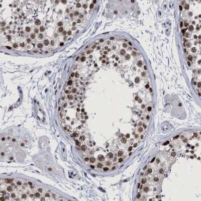 Immunohistochemistry-Paraffin: HCA59 Antibody [NBP1-83168]