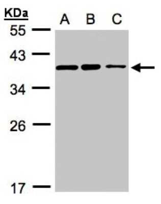 Western Blot: HCA59 Antibody [NBP1-32518]