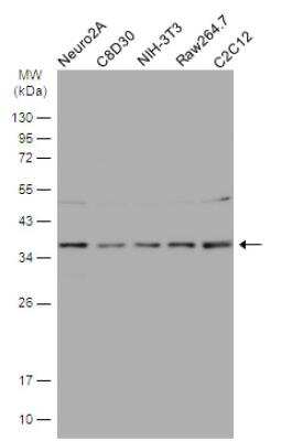 Western Blot: HCA59 Antibody [NBP1-32518]