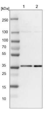 Western Blot: HCA59 Antibody [NBP1-83168]
