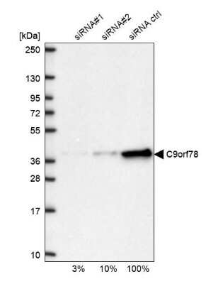 Western Blot: HCA59 Antibody [NBP1-83168]