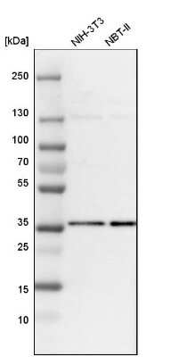 Western Blot: HCA59 Antibody [NBP1-83168]