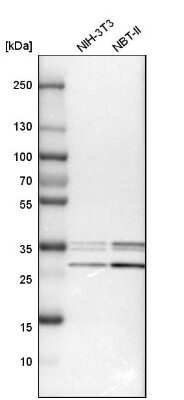 Western Blot: HCA59 Antibody [NBP1-83170]