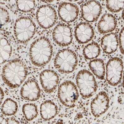 Immunohistochemistry-Paraffin: HCC1 Antibody [NBP1-88200]