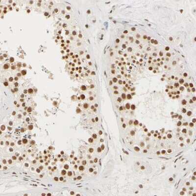 Immunohistochemistry-Paraffin: HCC1 Antibody [NBP1-88200]