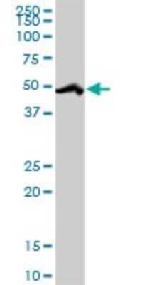 Western Blot: HCC1 Antibody [H00009584-D01P]