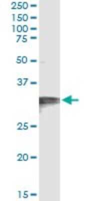 Immunoprecipitation: HCCS Antibody (3C7) [H00003052-M01]