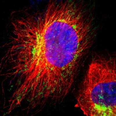Immunocytochemistry/ Immunofluorescence: HCCS Antibody [NBP1-86577]