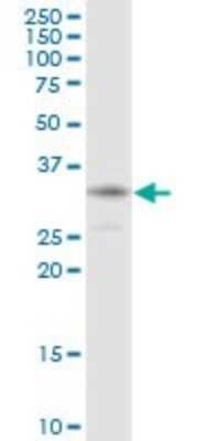 Western Blot: HCCS Antibody [H00003052-B01P]