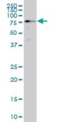 Western Blot: HCLS1 Antibody (1A8) [H00003059-M02]