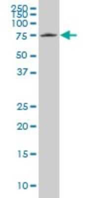 Western Blot: HCLS1 Antibody (2A6) [H00003059-M03]