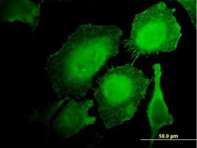 Immunocytochemistry/ Immunofluorescence: HCLS1 Antibody (2A9) [H00003059-M06]