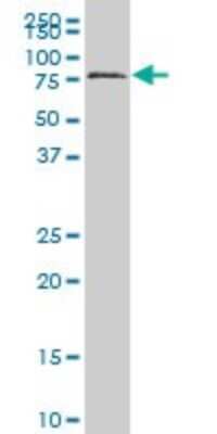 Western Blot: HCLS1 Antibody (2A9) [H00003059-M06]