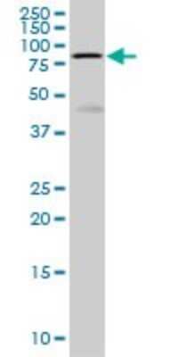 Western Blot: HCLS1 Antibody (3D5) [H00003059-M01]