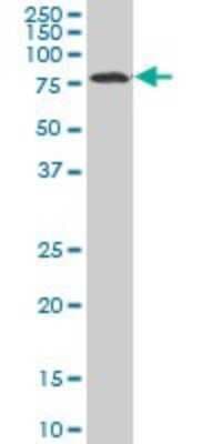 Western Blot: HCLS1 Antibody (3F4) [H00003059-M04]