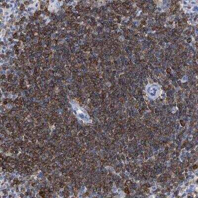 Immunohistochemistry-Paraffin: HCLS1 Antibody [NBP1-85380]