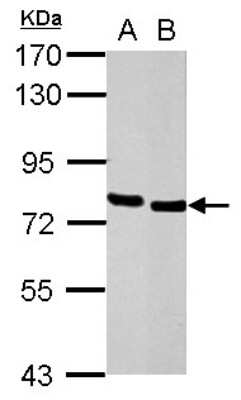 Western Blot: HCLS1 Antibody [NBP1-30953]