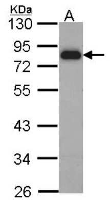 Western Blot: HCLS1 Antibody [NBP2-16787]