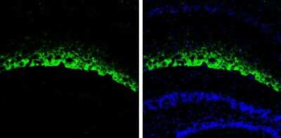 Immunohistochemistry-Frozen: HCN1 Antibody [NBP3-13014]