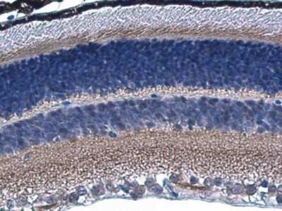 Immunohistochemistry-Paraffin: HCN1 Antibody [NBP3-13014]